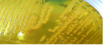 弧菌專用培養基（TCBS瓊脂）可分離到黃色或綠色的不同種類弧菌。